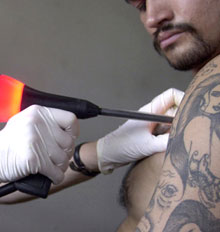 Alternatives to Tattoo Removals Alternatives to Tattoo Removals
