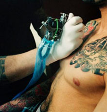 Risks of Tattoo Removal Risks of Tattoo Removal