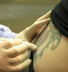 Taking Care After Tattoo Removal Taking Care After Tattoo Removal