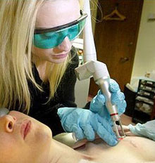 Tattoo Removal on the NHS Tattoo Removal on the NHS