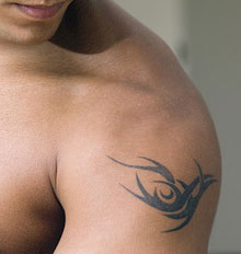 Tattoo Removal Reviews Tattoo Removal Reviews