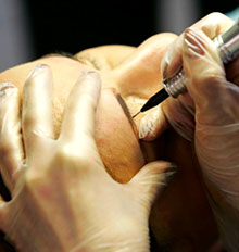 Tattoo Removal Semi Permanent Make Up Tattoo Removal Semi Permanent Make Up